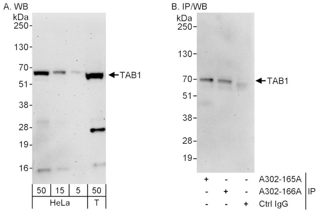 TAB1 Antibody in Western Blot (WB)