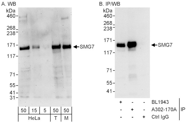 SMG7 Antibody in Western Blot (WB)