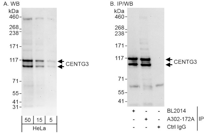 CENTG3 Antibody in Western Blot (WB)