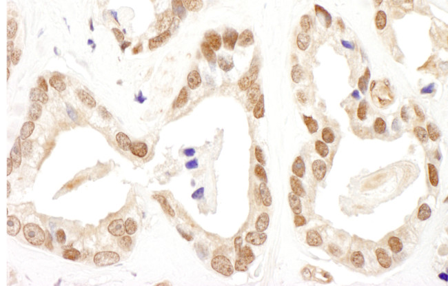 FANCD2 Antibody in Immunohistochemistry (Paraffin) (IHC (P))