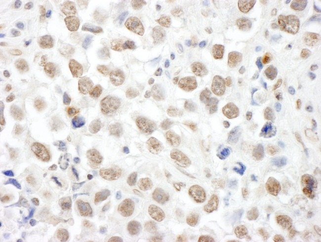 TOPORS Antibody in Immunohistochemistry (Paraffin) (IHC (P))