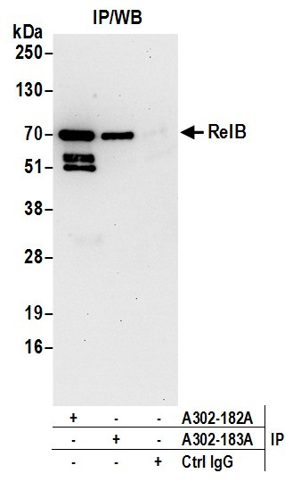 RelB Antibody in Immunoprecipitation (IP)