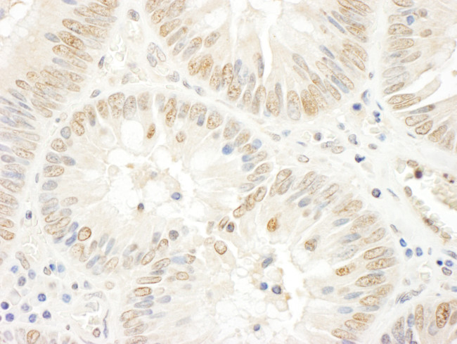 NOPP140 Antibody in Immunohistochemistry (Paraffin) (IHC (P))
