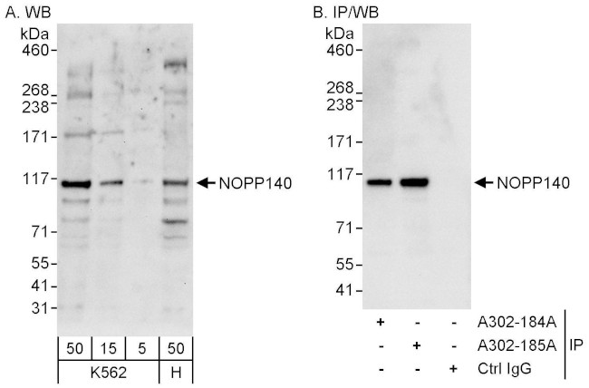 NOPP140 Antibody in Western Blot (WB)