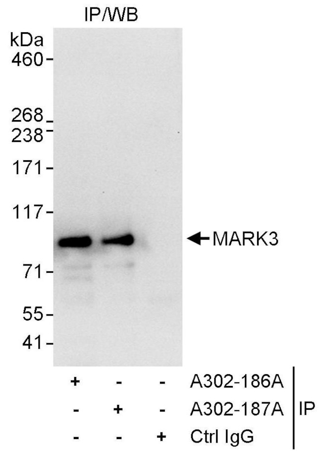 MARK3 Antibody in Immunoprecipitation (IP)