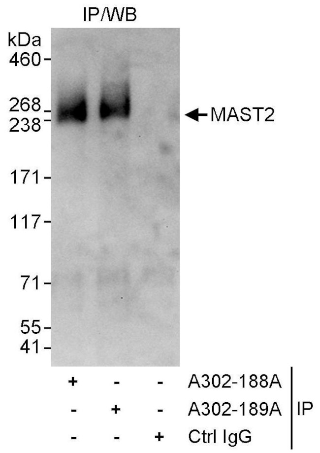 MAST2 Antibody in Immunoprecipitation (IP)