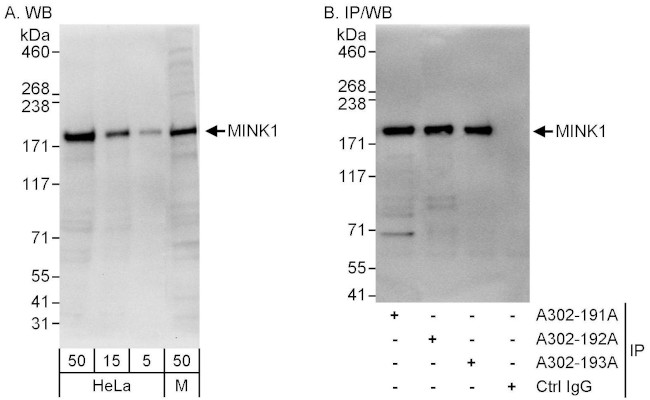 MINK1 Antibody in Western Blot (WB)