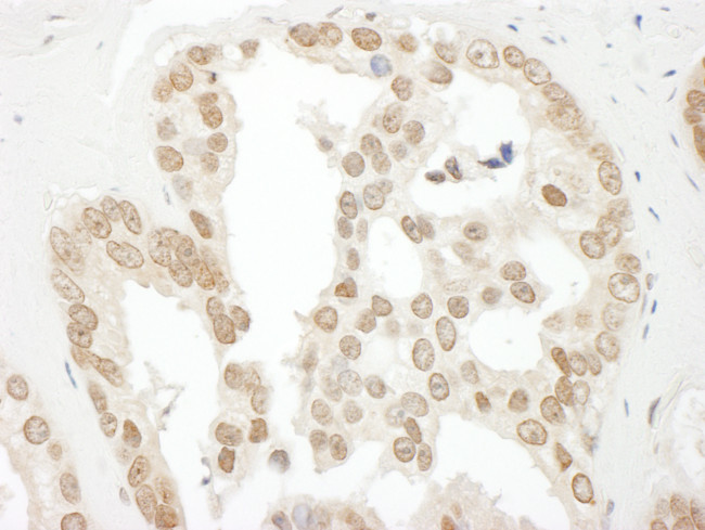 BCCIP Antibody in Immunohistochemistry (Paraffin) (IHC (P))