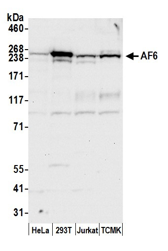 AF6 Antibody in Western Blot (WB)