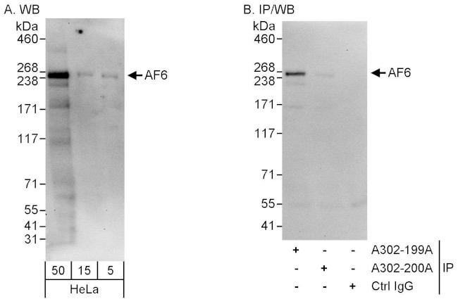 AF6 Antibody in Western Blot (WB)