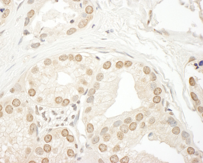 SMG9 Antibody in Immunohistochemistry (Paraffin) (IHC (P))