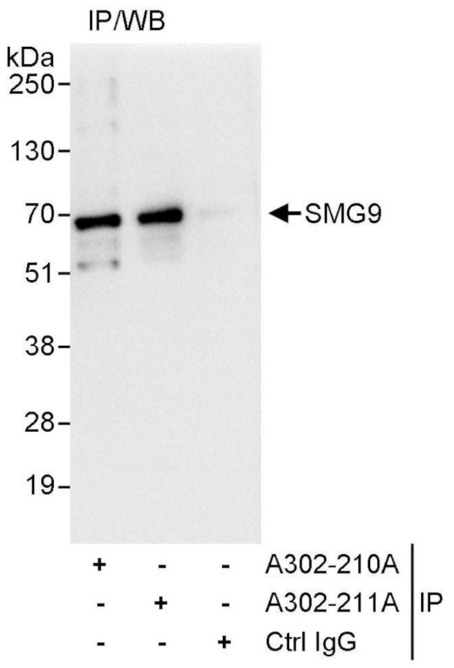 SMG9 Antibody in Immunoprecipitation (IP)