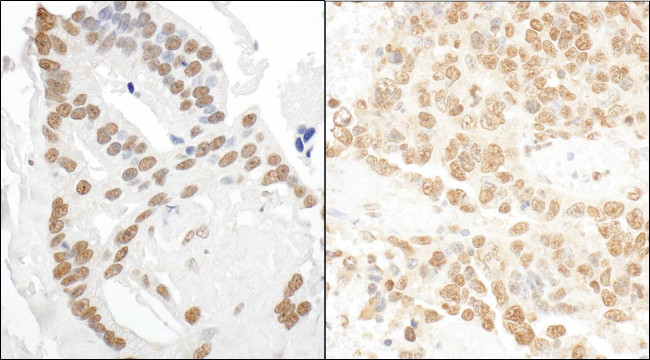 DDX27 Antibody in Immunohistochemistry (Paraffin) (IHC (P))