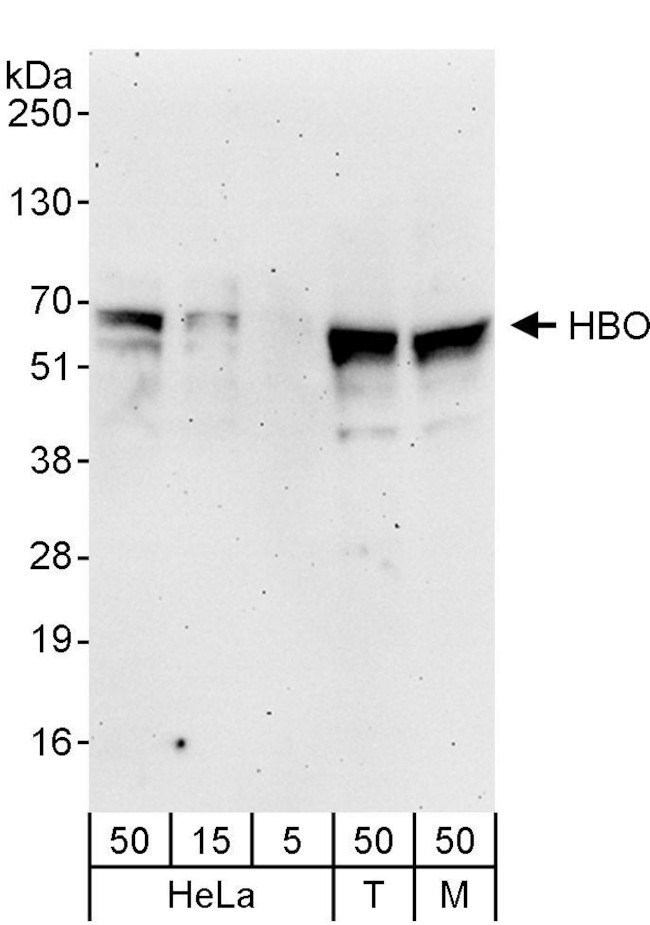 HBO Antibody in Western Blot (WB)