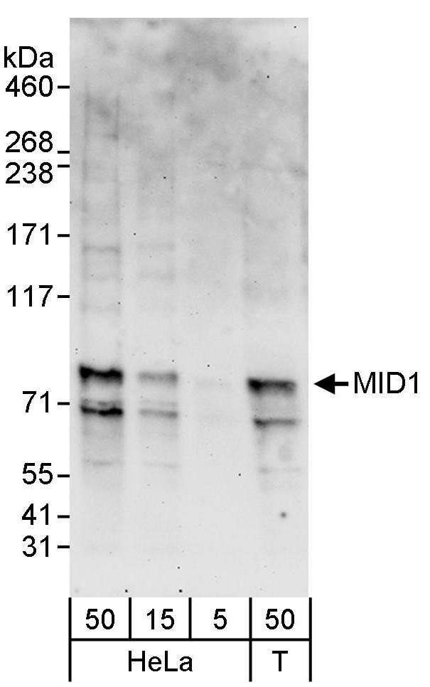 MID1 Antibody in Western Blot (WB)
