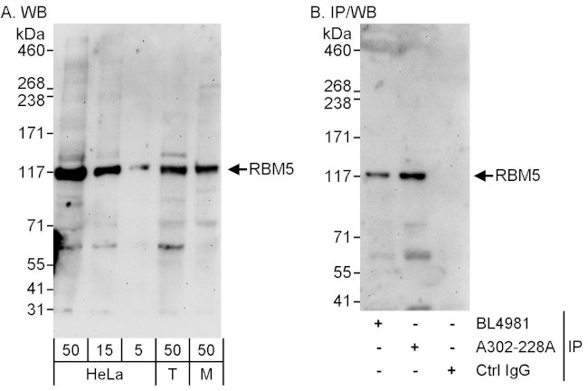RBM5 Antibody in Western Blot (WB)