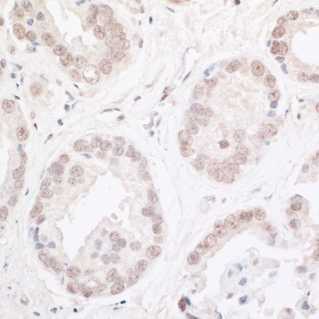 ARID2 Antibody in Immunohistochemistry (Paraffin) (IHC (P))