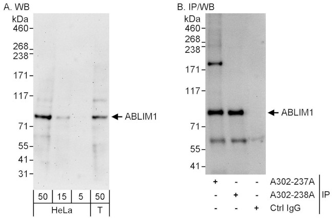 ABLIM1 Antibody in Western Blot (WB)