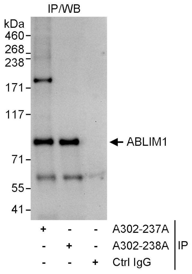 ABLIM1 Antibody in Immunoprecipitation (IP)