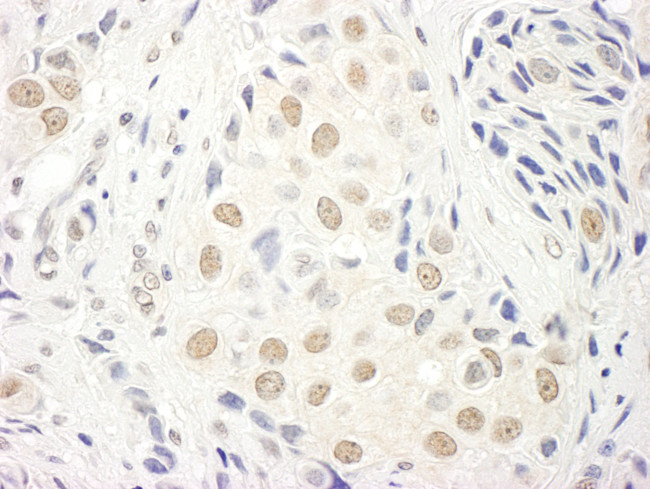 TFIIS Antibody in Immunohistochemistry (Paraffin) (IHC (P))