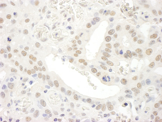 TFIIS Antibody in Immunohistochemistry (Paraffin) (IHC (P))