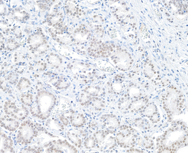 BAP1 Antibody in Immunohistochemistry (Paraffin) (IHC (P))