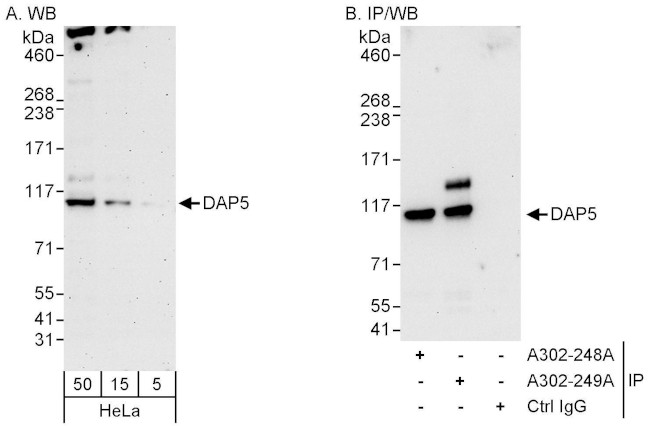 DAP5 Antibody in Western Blot (WB)