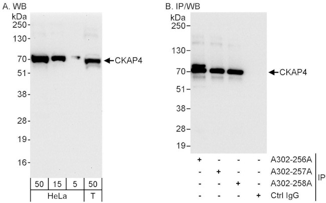 CKAP4 Antibody in Western Blot (WB)