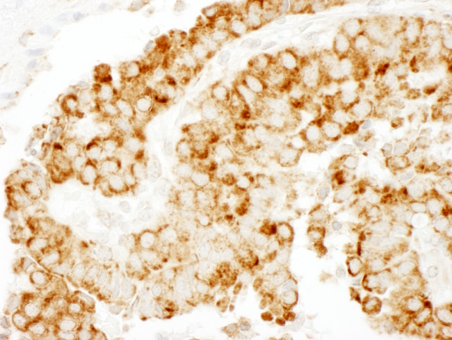 CKAP4 Antibody in Immunohistochemistry (Paraffin) (IHC (P))