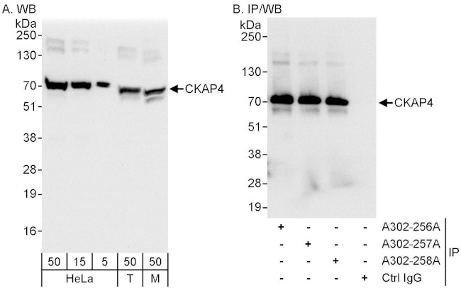 CKAP4 Antibody in Western Blot (WB)