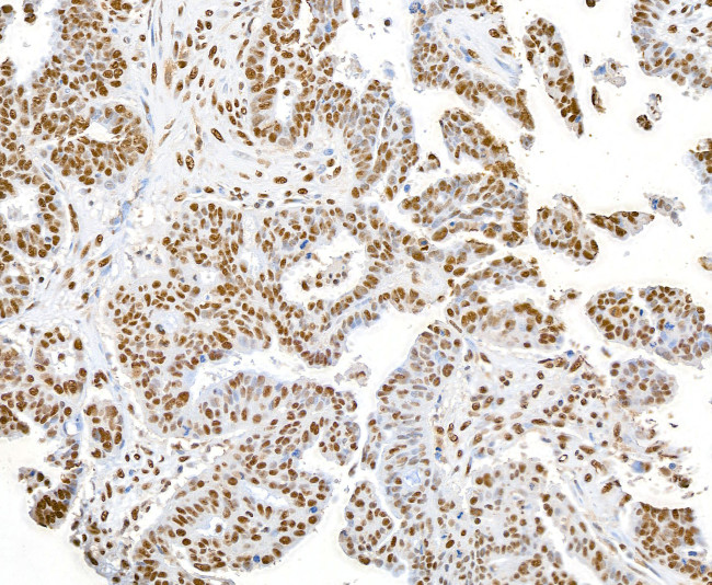 SET Antibody in Immunohistochemistry (Paraffin) (IHC (P))