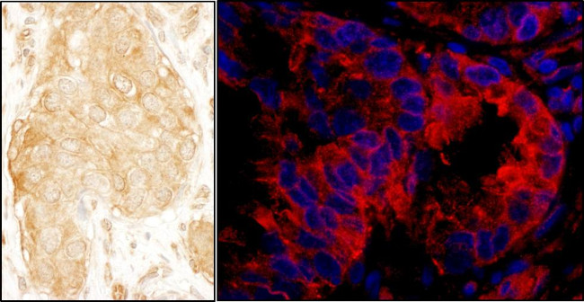 SASH1 Antibody in Immunohistochemistry (Paraffin) (IHC (P))