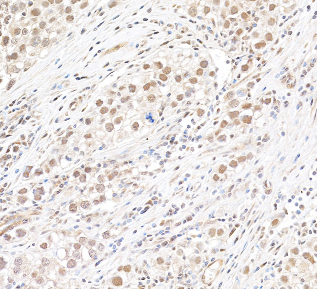 MLLT1 Antibody in Immunohistochemistry (Paraffin) (IHC (P))