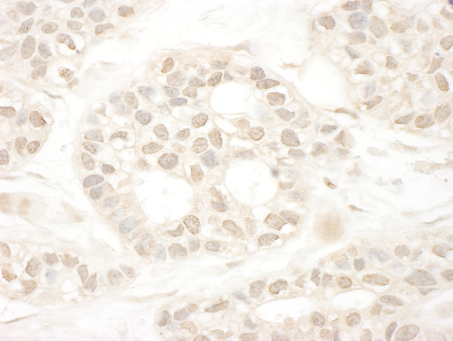 ARA70 Antibody in Immunohistochemistry (Paraffin) (IHC (P))