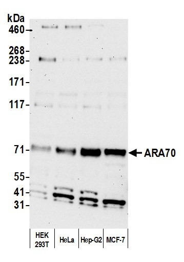 ARA70 Antibody in Western Blot (WB)