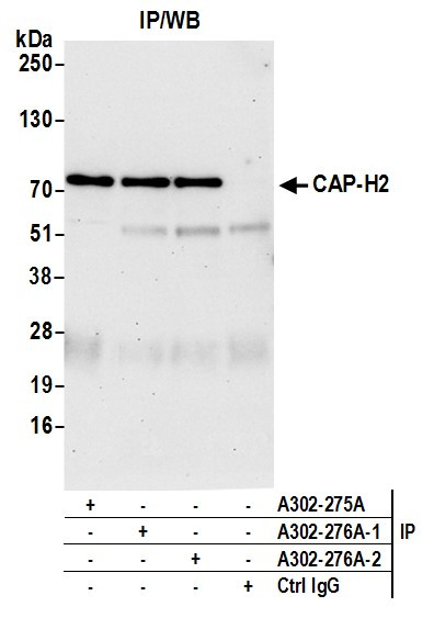 CAP-H2 Antibody in Immunoprecipitation (IP)