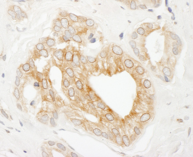 p600 Antibody in Immunohistochemistry (Paraffin) (IHC (P))