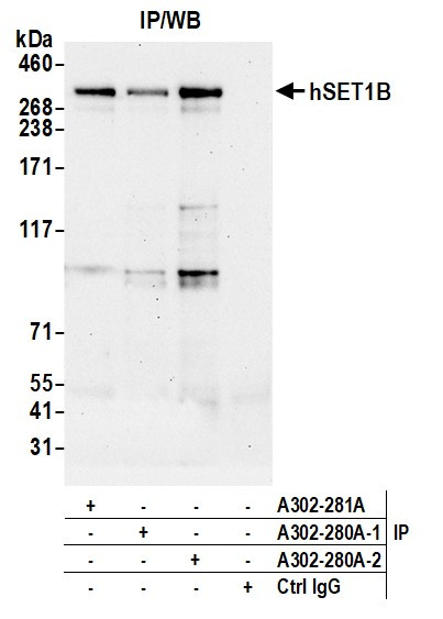 hSET1B Antibody in Immunoprecipitation (IP)