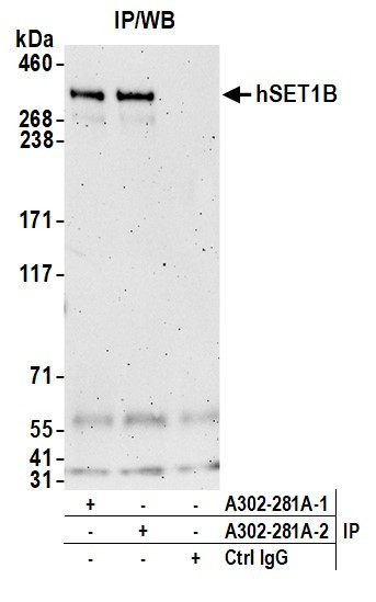 hSET1B Antibody in Immunoprecipitation (IP)
