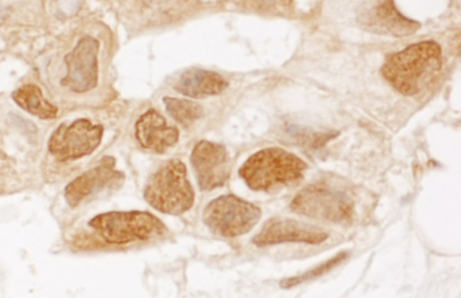 TIGAR Antibody in Immunohistochemistry (Paraffin) (IHC (P))
