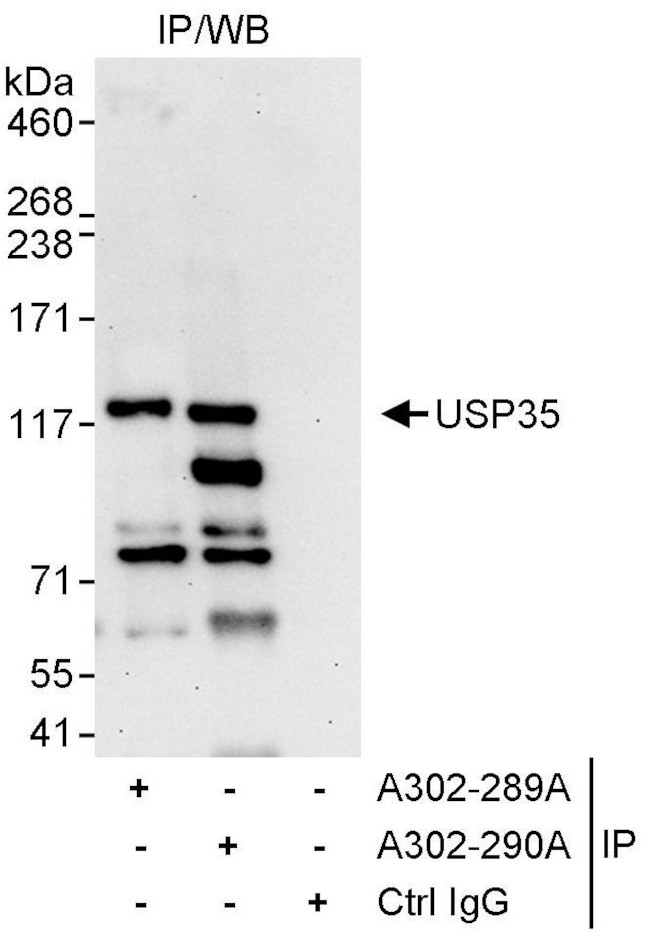 USP35 Antibody in Immunoprecipitation (IP)