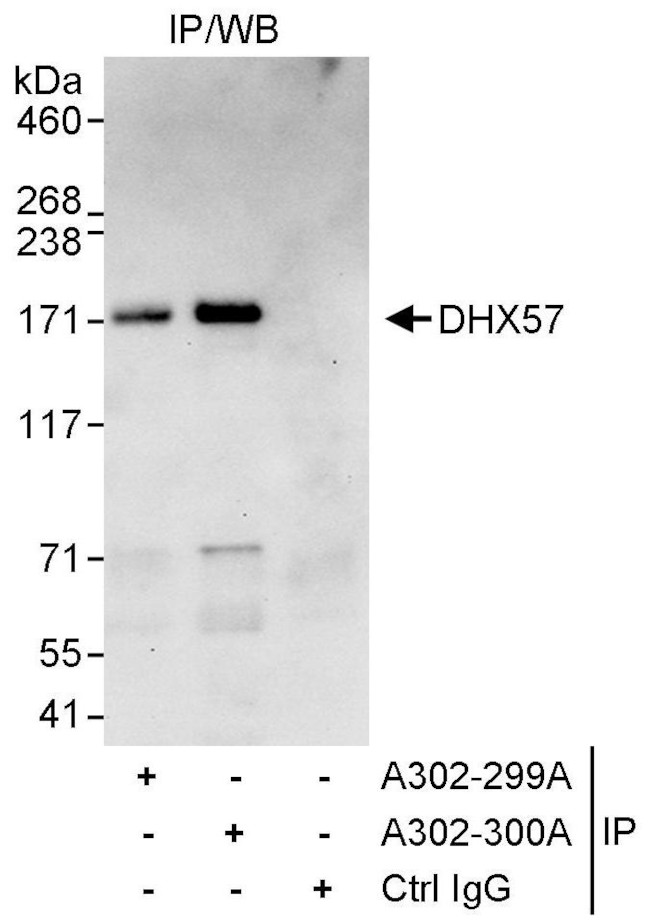 DHX57 Antibody in Immunoprecipitation (IP)