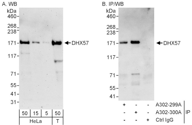 DHX57 Antibody in Western Blot (WB)
