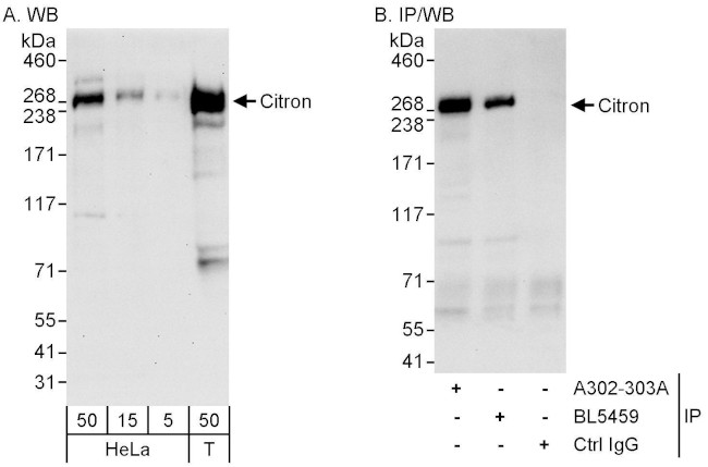 Citron Antibody in Western Blot (WB)