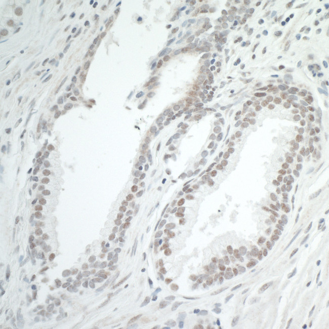 BRD7 Antibody in Immunohistochemistry (Paraffin) (IHC (P))