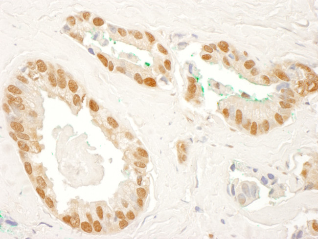 RAD23B Antibody in Immunohistochemistry (Paraffin) (IHC (P))