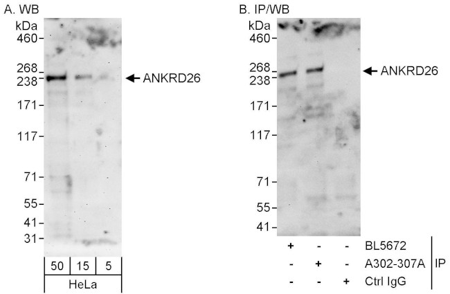 ANKRD26 Antibody in Western Blot (WB)