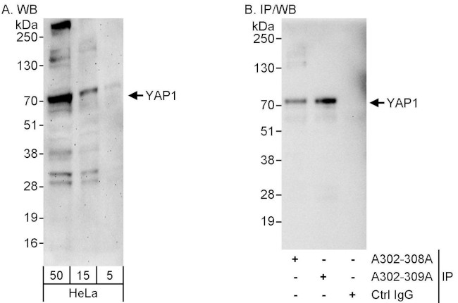YAP1 Antibody in Western Blot (WB)