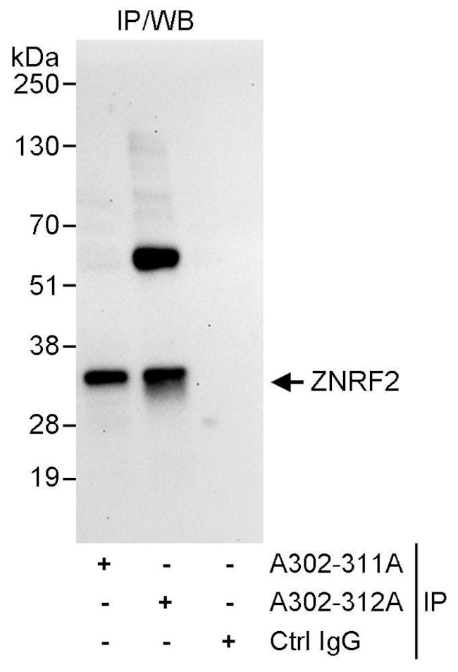 ZNRF2 Antibody in Immunoprecipitation (IP)