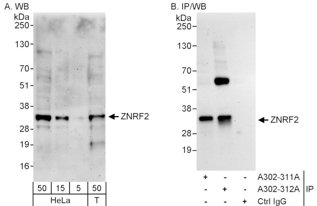 ZNRF2 Antibody in Western Blot (WB)